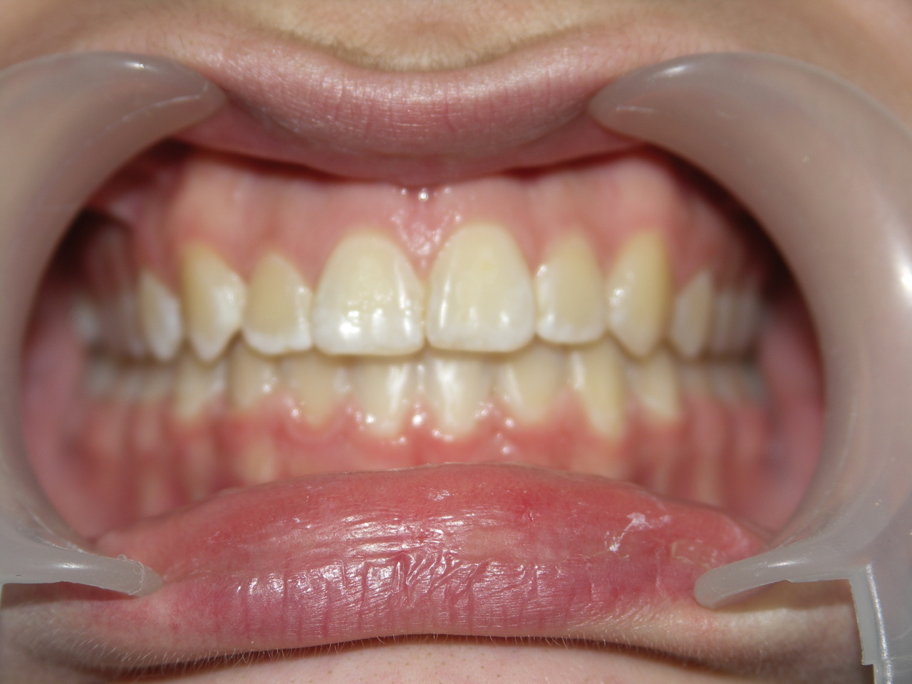 Dobry ortodonta Łódź i metamorfozy pacjentów