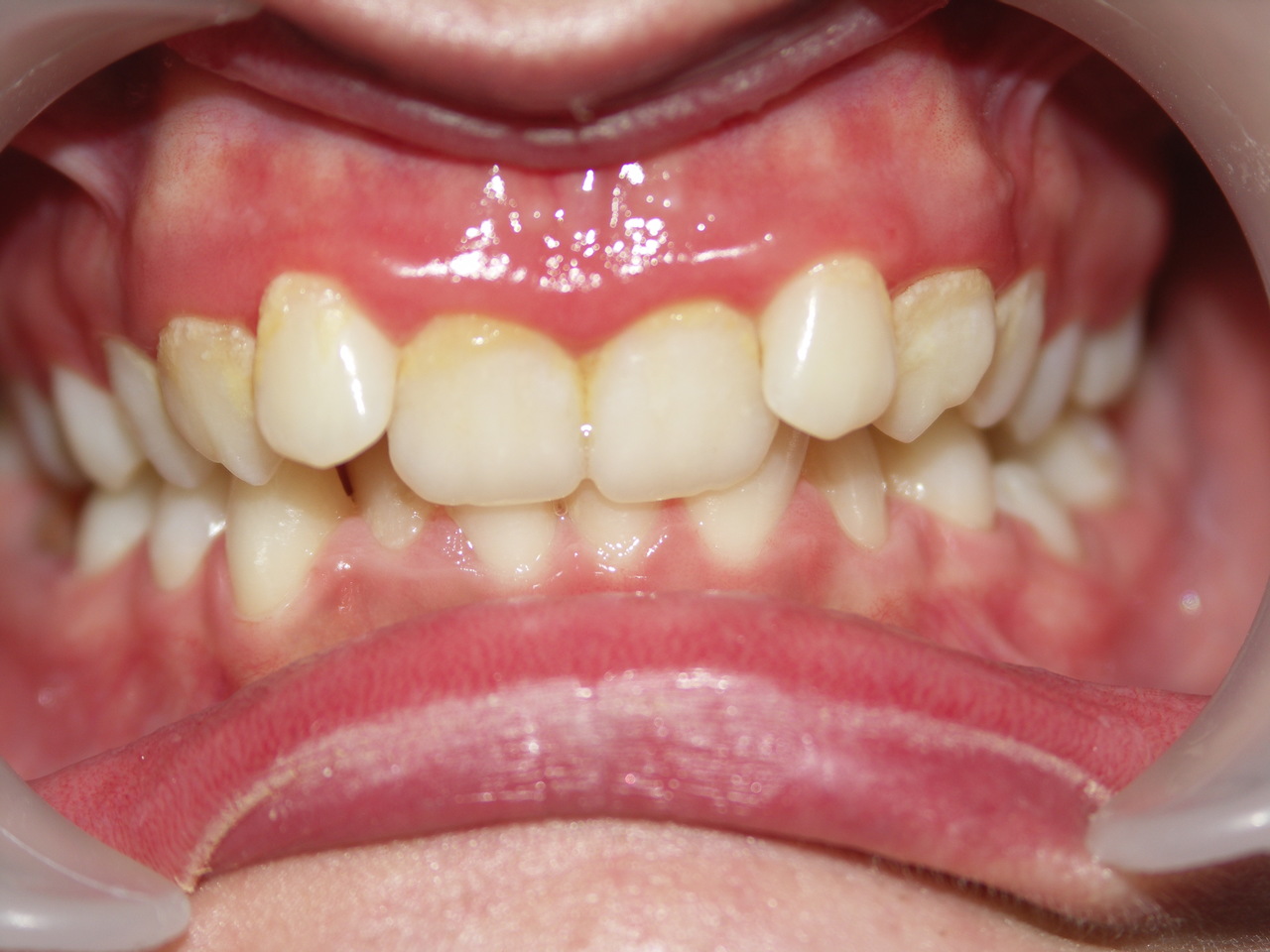 Dobry ortodonta Łódź i metamorfozy pacjentów